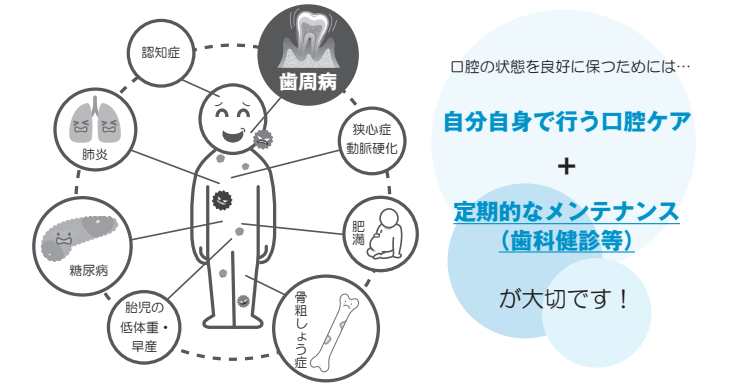 歯周病と病気の関係